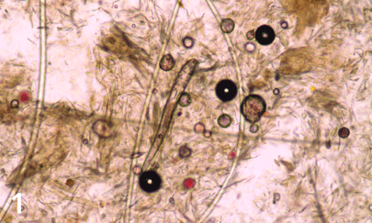 Hình ảnh ve Demodex hình điếu xì gà bám trong nang lông chó