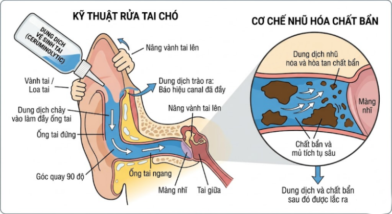 Cơ chế nhũ hóa và làm sạch ống tai bằng dung dịch tan sáp.