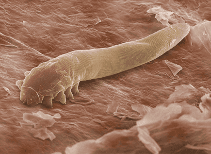 Vi thể Demodex