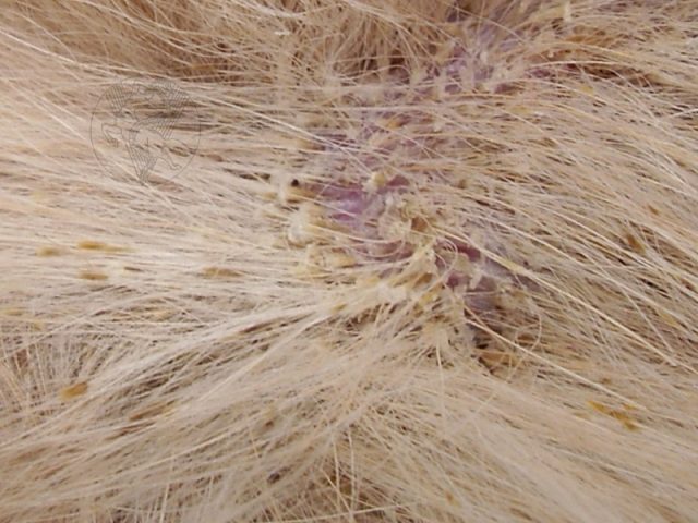 gàu nhờn viêm da tiết bã