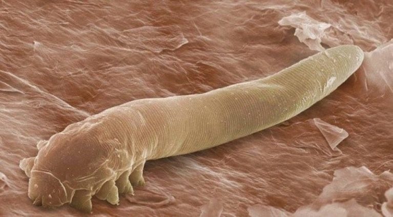 Hình ảnh ký sinh trùng Demodex dưới kính hiển vi