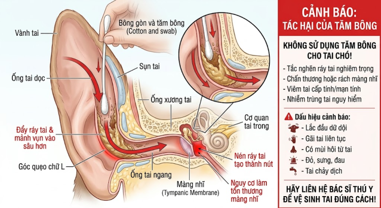 Minh họa rủi ro khi dùng tăm bông vệ sinh tai chó mèo.