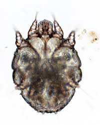 Vi phẫu Sarcoptes
