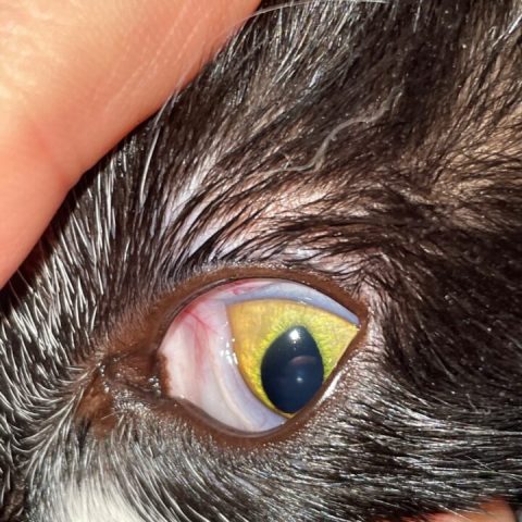 Tình trạng xung huyết dội ngược do lạm dụng thuốc nhỏ mắt chứa chất co mạch.