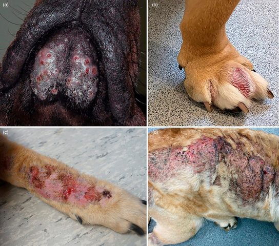 Cảnh báo biến chứng viêm da mủ sâu do vi khuẩn đâm thủng hạ bì từ Hotspot