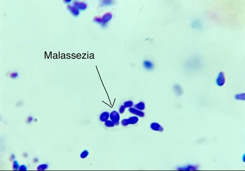 Hình ảnh tế bào học nấm men Malassezia hình hạt đậu phộng.